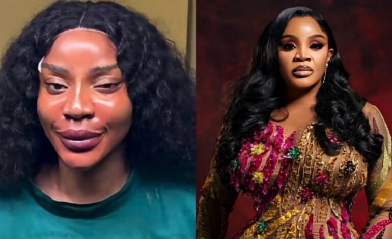 ‘I got me a new face’ – Uche Ogbodo announces threads, fillers, PDO treatments