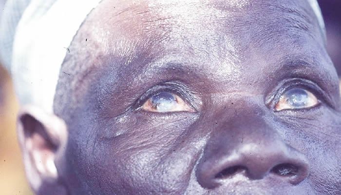 White Cane Day: Visually impaired seek safer roads, jobs
